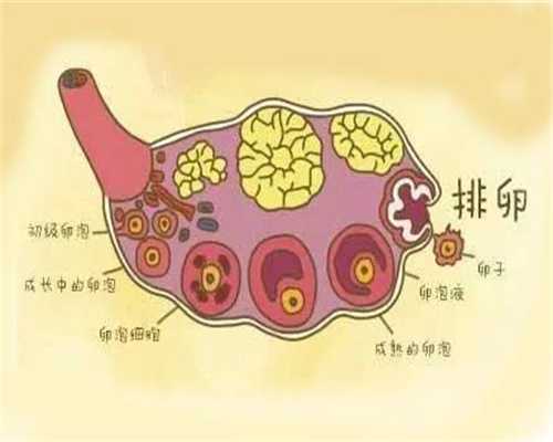 广州代孕自愿者：几招帮你了解4种孕期腹痛