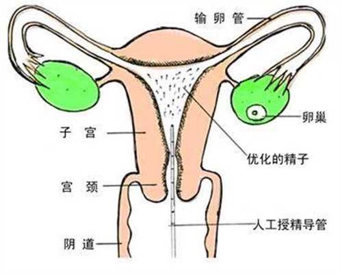 广州圆梦助孕,怀孕期间的运动：怀孕的妈妈如何