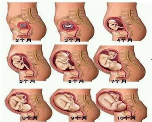 在怀孕晚期的女性为何经常会失眠原来和这4点有