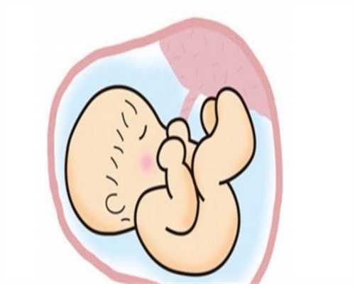 怀孕50多天，胎儿没胎心胎芽是不在了吗孕囊、胎