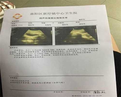 广州哪里有代妈招聘,怀孕30周实际只有26周，胎儿