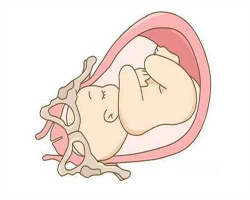 孕期12周却查出NT不过关，胎儿还能不能留