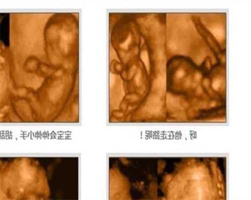 广州人工受孕哪家好,怀孕6个月如此“精致”，高