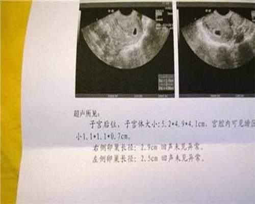 广州代孕公司汪小兵,孕期孕妈恶心、呕吐，怀孕