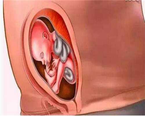 广州代孕中介,处女也会得宫颈息肉吗 对怀孕是否