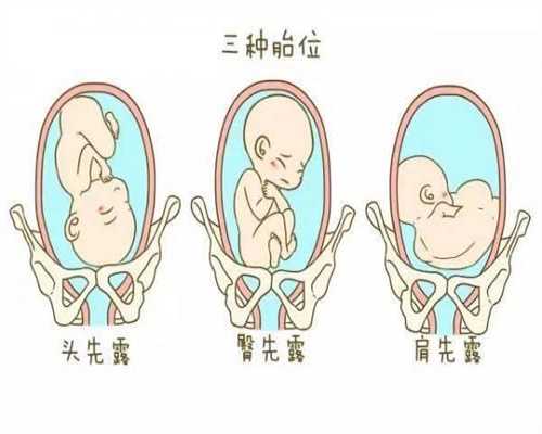 <b>胎记是孕期妈妈乱吃东西造成的不懂的，不妨看</b>