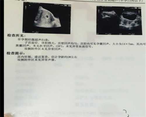 广州那招代妈,顺产6.4斤女宝宝，分享一点有用的