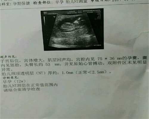 广州世纪助孕官网,备孕合理调理是重点，保证怀