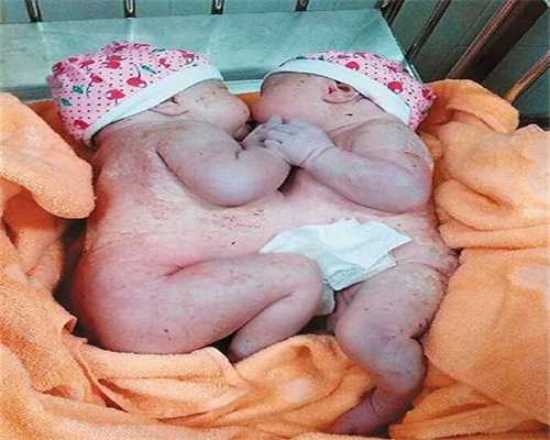 广州代生小孩的女孩,怀孕8个月了，为什么肚脐眼