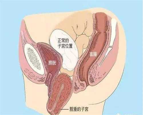 广州找人代生孩子,注重健康日常习惯，顺利怀孕
