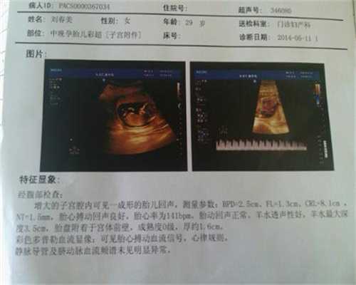 <b>广州代孕需要多少费用_宝宝不开胃怎么办</b>