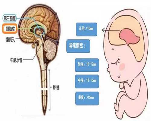 广州代孕产子的流程_怀孕得了尖锐疣怎么办