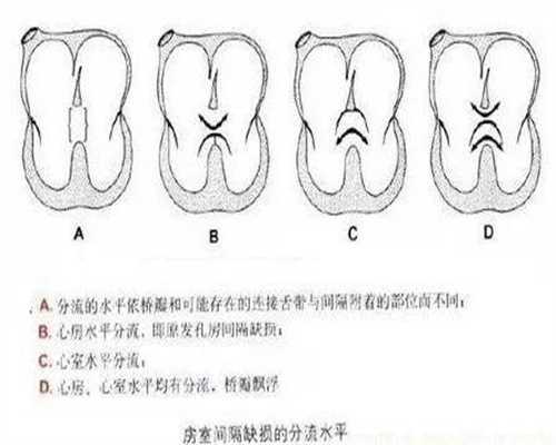 广州代孕双胞胎价格是多少_羊水穿刺有必要做吗
