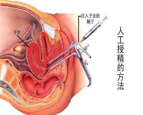 广州代孕一个须多少钱_三个月婴儿吃什么钙好