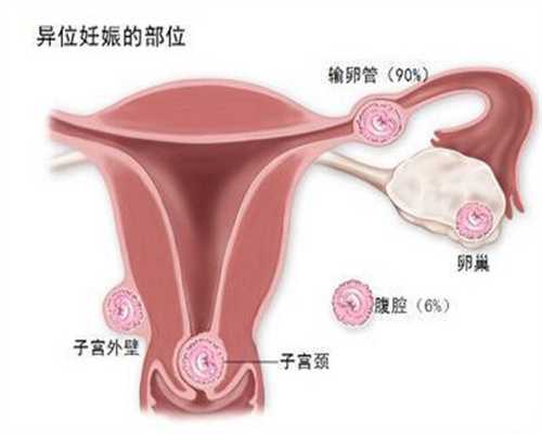 广州代孕生子费用_37周胎儿双顶径9.7还会长吗