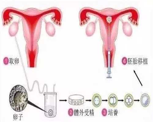 广州代孕成功率是多少_女性吃什么东西杀精子