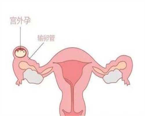 <b>广州代生儿子成功率_早早孕试纸晚上测有用吗</b>
