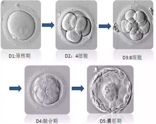 广州专业的代孕包成功套餐_广州代孕最好医院