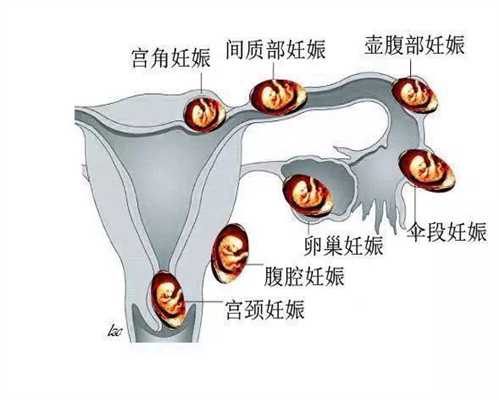 广州正规机构代孕孩子_广州哪里有代孕的人