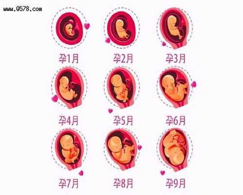 广州助孕公司机构_孕妇水肿怎么预防 有哪些食疗方法可以去除水肿