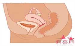 广州做试管取卵-做代孕能生男孩吗_子宫畸形影响生育吗？子宫畸形都有哪些危