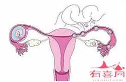 代孕包成功吗-广州艾滋病患者代孕_英国夫妇利用冷冻10多年的精子诞生出试管